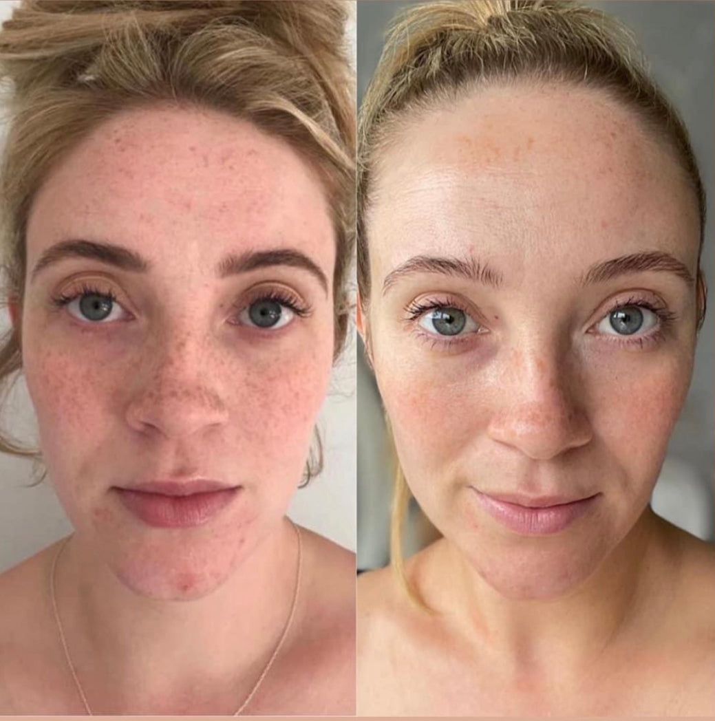 ageLOC Boost Kit – Thebeautylifestylecode